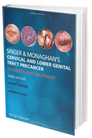 Cervical and Lower Genital Tract Pre cancer: Diagnosis and Treatment book cover