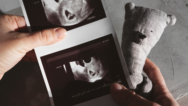 Person holding a black and white ultrasound image and a small bear plush toy, suggesting themes of pregnancy and anticipation.